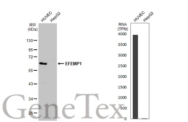 Anti-EFEMP1 antibody used in Western Blot (WB). GTX111657