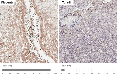 Anti-EFEMP1 antibody used in IHC (Paraffin sections) (IHC-P). GTX111657