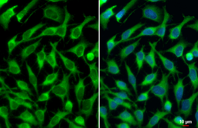 Anti-IDE antibody [N3C1], Internal used in Immunocytochemistry/ Immunofluorescence (ICC/IF). GTX111664