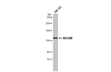 Anti-NCAM antibody used in Western Blot (WB). GTX111684
