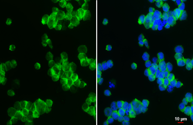 Anti-NCAM antibody used in Immunocytochemistry/ Immunofluorescence (ICC/IF). GTX111684