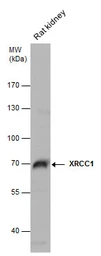 Anti-XRCC1 antibody [N1N3] used in Western Blot (WB). GTX111712