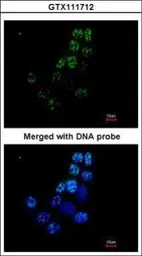 Anti-XRCC1 antibody [N1N3] used in Immunocytochemistry/ Immunofluorescence (ICC/IF). GTX111712
