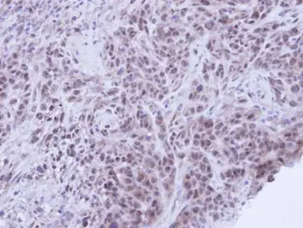 Anti-XRCC1 antibody [N1N3] used in IHC (Paraffin sections) (IHC-P). GTX111712
