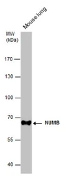 Anti-NUMB antibody [N1N3] used in Western Blot (WB). GTX111715