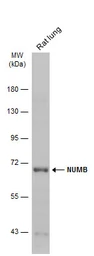 Anti-NUMB antibody [N1N3] used in Western Blot (WB). GTX111715