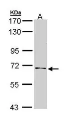 Anti-NUMB antibody [N1N3] used in Western Blot (WB). GTX111715