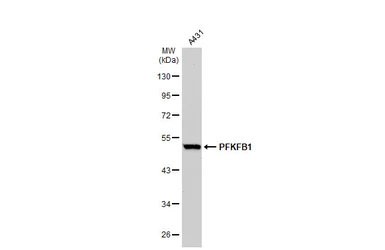 Anti-PFKFB1 antibody [N1N3] used in Western Blot (WB). GTX111733