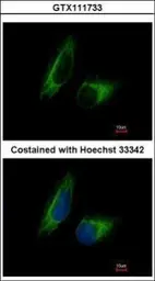 Anti-PFKFB1 antibody [N1N3] used in Immunocytochemistry/ Immunofluorescence (ICC/IF). GTX111733
