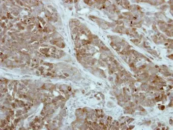 Anti-PFKFB1 antibody [N1N3] used in IHC (Paraffin sections) (IHC-P). GTX111733