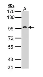 Anti-CD290 / TLR10 antibody [C2C3], C-term used in Western Blot (WB). GTX111735