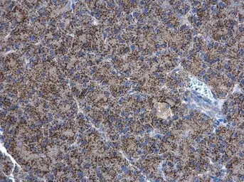 Anti-Adenylate kinase 2 antibody [N1C3-2] used in IHC (Paraffin sections) (IHC-P). GTX111737