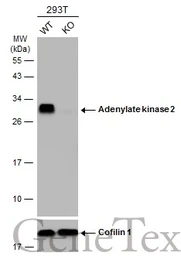 Anti-Adenylate kinase 2 antibody [N1C3-2] used in Western Blot (WB). GTX111737
