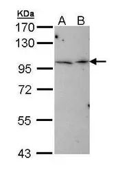 Anti-TBCK antibody [C1C2], Internal used in Western Blot (WB). GTX111742