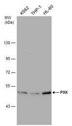 Anti-PXK antibody [N2C2], Internal used in Western Blot (WB). GTX111746