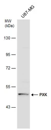 Anti-PXK antibody [N2C2], Internal used in Western Blot (WB). GTX111746