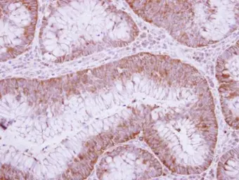 Anti-Urokinase antibody used in IHC (Paraffin sections) (IHC-P). GTX111747