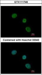 Anti-ELP4 antibody used in Immunocytochemistry/ Immunofluorescence (ICC/IF). GTX111748