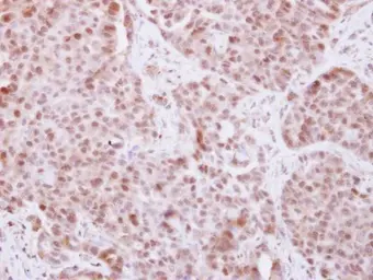 Anti-ELP4 antibody used in IHC (Paraffin sections) (IHC-P). GTX111748