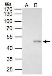Anti-ELP4 antibody used in Immunoprecipitation (IP). GTX111748