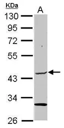 Anti-ELP4 antibody used in Western Blot (WB). GTX111748