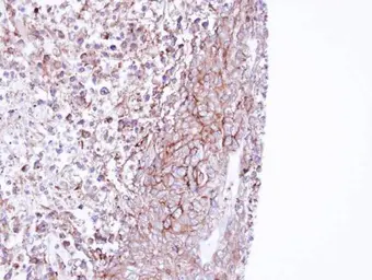 Anti-MPP1 antibody [N1C1] used in IHC (Paraffin sections) (IHC-P). GTX111779