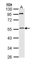 Anti-MPP1 antibody [N1C1] used in Western Blot (WB). GTX111779