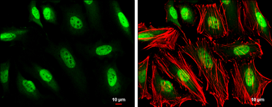Anti-GTF2H1 antibody [N1C1] used in Immunocytochemistry/ Immunofluorescence (ICC/IF). GTX111804