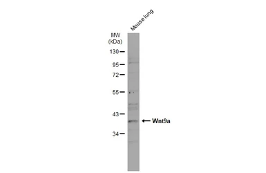 Anti-Wnt9a antibody [N1N2], N-term used in Western Blot (WB). GTX111855