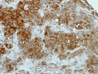 Anti-GCLM antibody [N1N3] used in IHC (Paraffin sections) (IHC-P). GTX111858