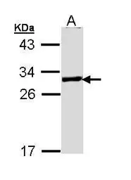 Anti-GCLM antibody [N1N3] used in Western Blot (WB). GTX111858