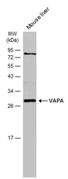Anti-VAPA antibody [N1N3] used in Western Blot (WB). GTX111859