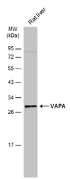 Anti-VAPA antibody [N1N3] used in Western Blot (WB). GTX111859