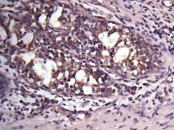 Anti-VAPA antibody [N1N3] used in IHC (Paraffin sections) (IHC-P). GTX111859