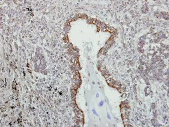 Anti-VAPA antibody [N1N3] used in IHC (Paraffin sections) (IHC-P). GTX111859