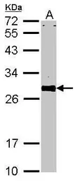 Anti-VAPA antibody [N1N3] used in Western Blot (WB). GTX111859