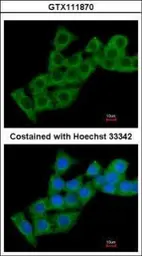 Anti-Calcium binding protein p22 antibody [N2C2], Internal used in Immunocytochemistry/ Immunofluorescence (ICC/IF). GTX111870