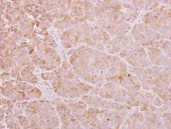 Anti-Calcium binding protein p22 antibody [N2C2], Internal used in IHC (Paraffin sections) (IHC-P). GTX111870