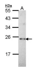 Anti-Calcium binding protein p22 antibody [N2C2], Internal used in Western Blot (WB). GTX111870