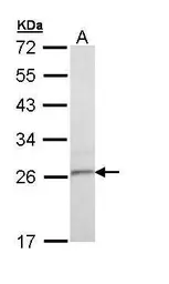 Anti-TSPAN6 antibody [C1C3] used in Western Blot (WB). GTX111881