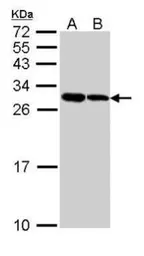 Anti-NOL3 antibody used in Western Blot (WB). GTX111883