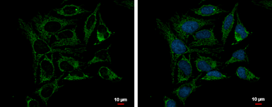 Anti-PRX III antibody [C2C3], C-term used in Immunocytochemistry/ Immunofluorescence (ICC/IF). GTX111887
