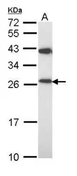Anti-PRX III antibody [C2C3], C-term used in Western Blot (WB). GTX111887