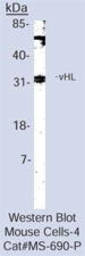Anti-Von Hippel Lindau antibody [3F391] used in Western Blot (WB). GTX11189