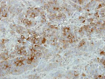 Anti-SFRP2 antibody [C2C3], C-term used in IHC (Paraffin sections) (IHC-P). GTX111892