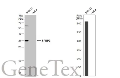 Anti-SFRP2 antibody [C2C3], C-term used in Western Blot (WB). GTX111892