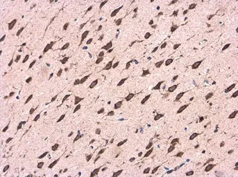 Anti-CDK5RAP1 antibody used in IHC (Paraffin sections) (IHC-P). GTX111910
