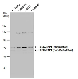 Anti-CDK5RAP1 antibody used in Western Blot (WB). GTX111910