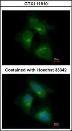 Anti-CDK5RAP1 antibody used in Immunocytochemistry/ Immunofluorescence (ICC/IF). GTX111910