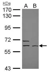 Anti-ELP3 antibody [N3C3] used in Western Blot (WB). GTX111912